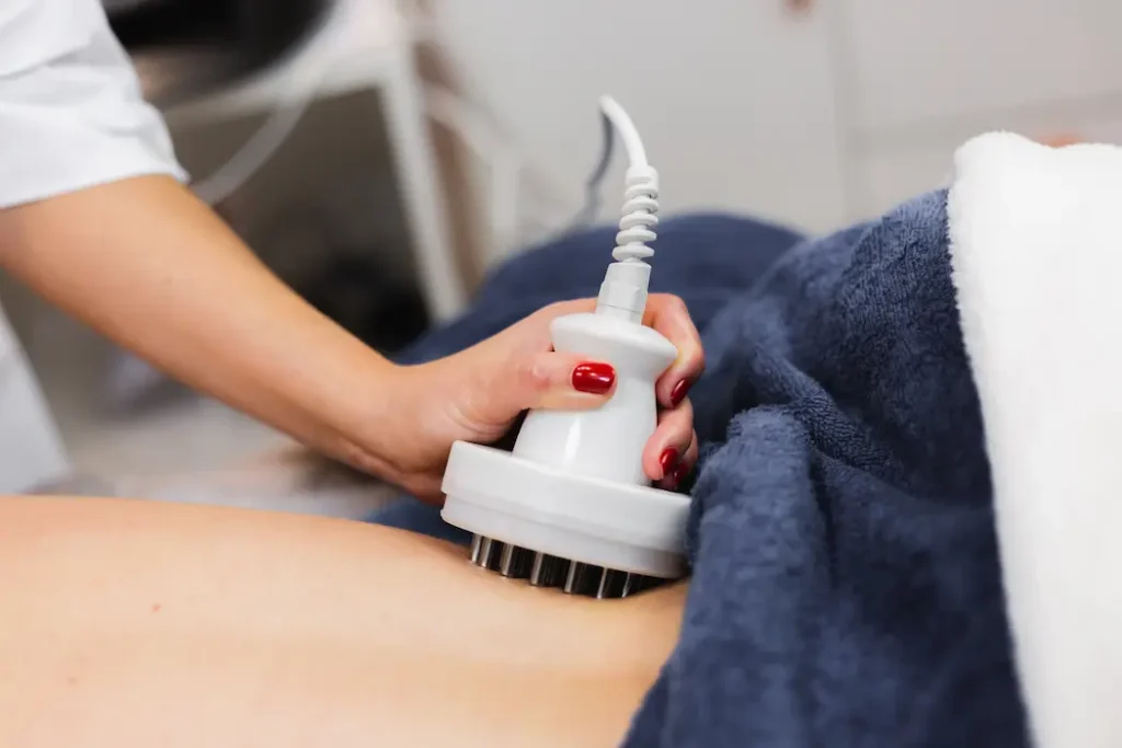 Subtle yet effective fat reduction treatment on the upper arm using Miami body contouring technology.