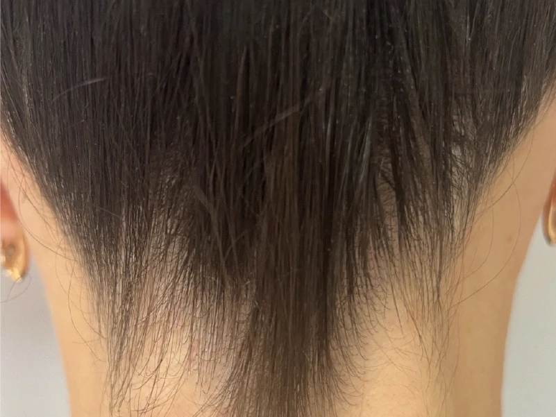 hair-before-after-01