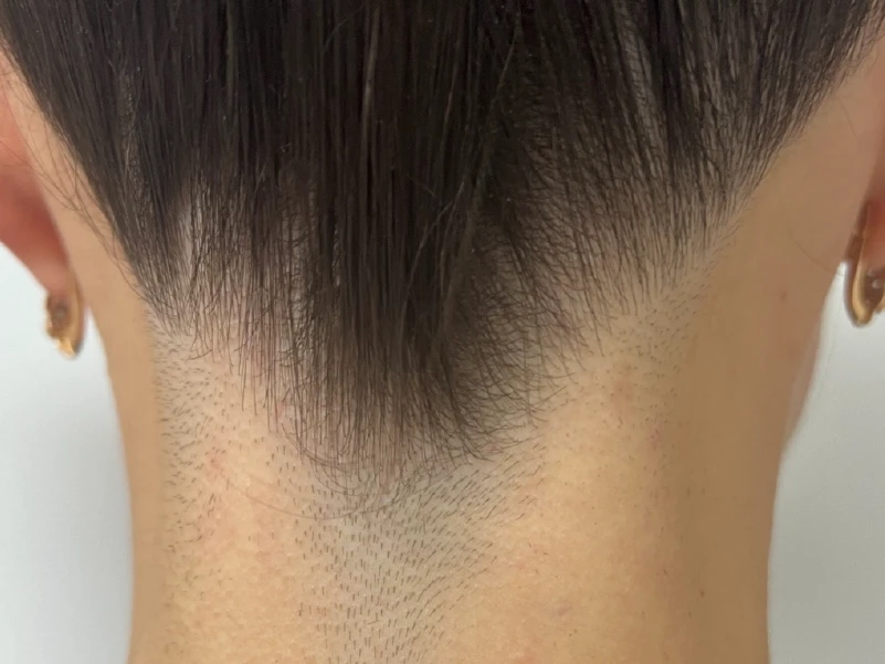 hair-before-after-02