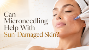 Can Microneedling Help With Sun-Damaged Skin